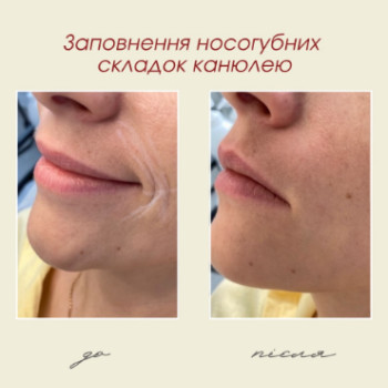 Фото с портфолио Dr. Gomon Cosmetology