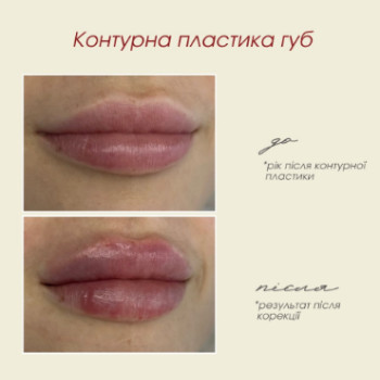 Фото с портфолио Dr. Gomon Cosmetology