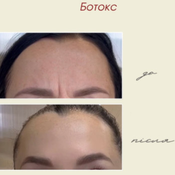 Фото с портфолио Dr. Gomon Cosmetology