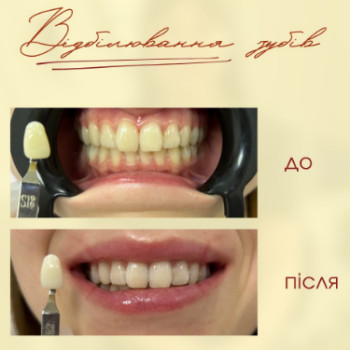Фото с портфолио Dr. Gomon Cosmetology