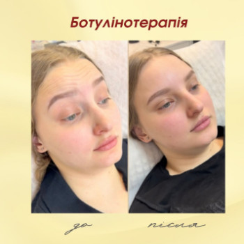 Фото с портфолио Dr. Gomon Cosmetology