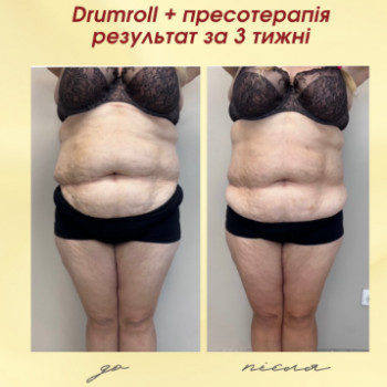 Фото с портфолио Dr. Gomon Cosmetology