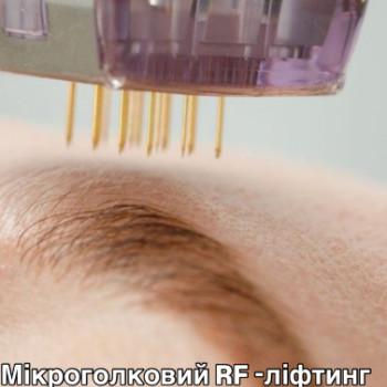 Фото с портфолио Алекс 