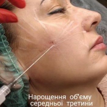 Фото с портфолио Наталия Мартыненко