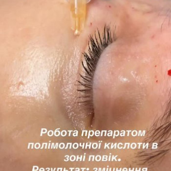 Фото с портфолио Наталия Мартыненко