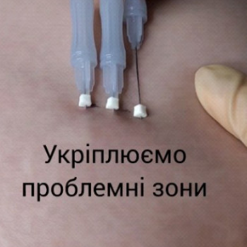 Фото с портфолио Наталия Мартыненко