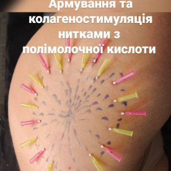 Фото с портфолио Наталия Мартыненко