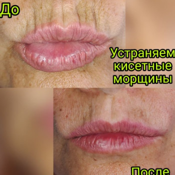 Фото с портфолио Наталия Мартыненко