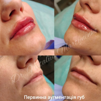 Фото с портфолио Наталия Мартыненко