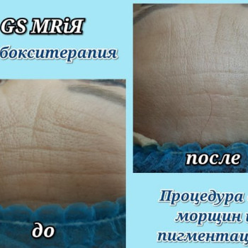 Фото с портфолио Мрия