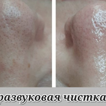 Фото с портфолио Мрия