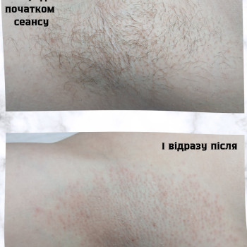 Фото с портфолио Наталія Вінник
