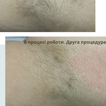 Фото с портфолио Наталія Вінник