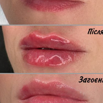 Фото с портфолио Оксана Ткаченко