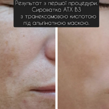 Фото с портфолио Елена Маскулова