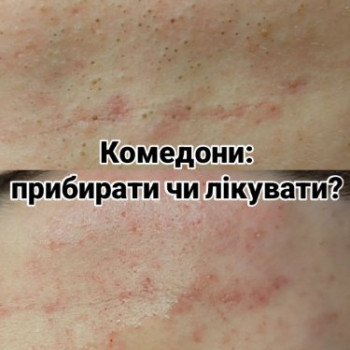 Фото с портфолио Татьяна Гончарова