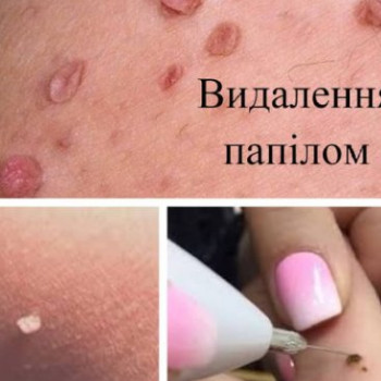 Фото с портфолио Альона Петрівна Пеліх