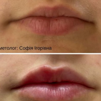 Фото с портфолио FineLine