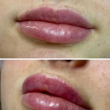 Фото с портфолио FineLine