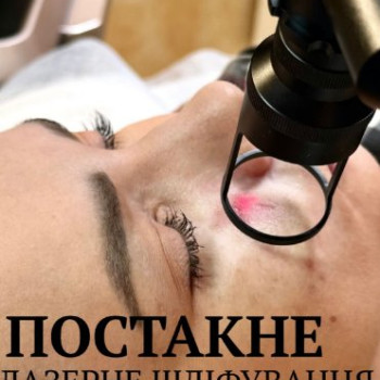 Фото с портфолио FineLine
