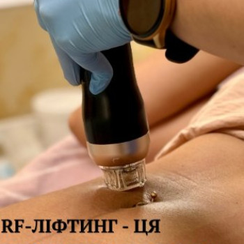 Фото с портфолио FineLine