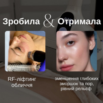 Фото с портфолио FineLine