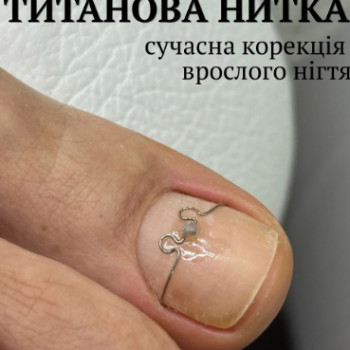 Фото с портфолио FineLine