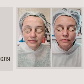 Фото с портфолио Віталія 