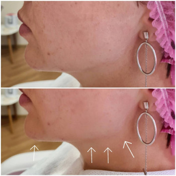 Фото с портфолио Віталія 