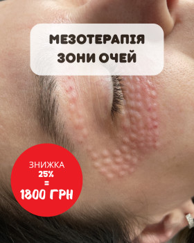 Perfect Skin