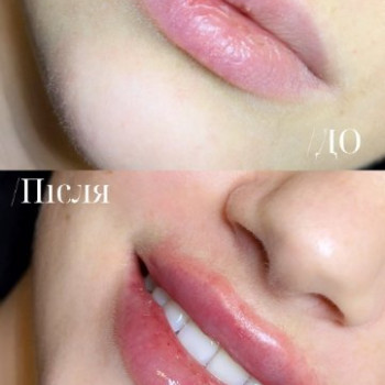 Фото с портфолио Ліна Гетьман