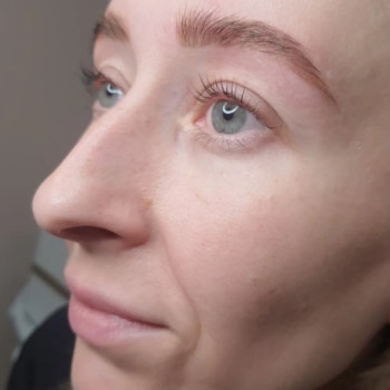 Фото с портфолио Laser&Beauty