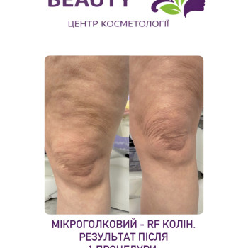 Фото с портфолио Оля Мельник