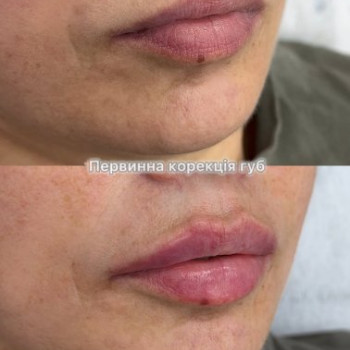 Фото с портфолио Face to Face