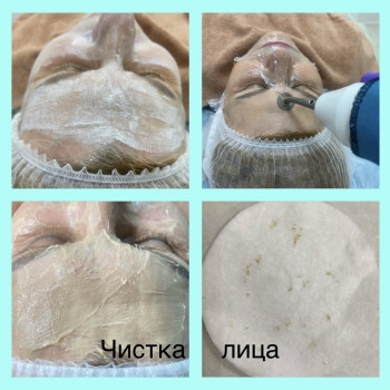 Чистка обличчя