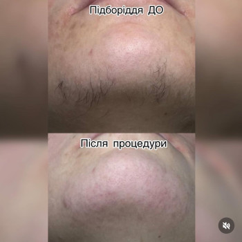 Фото с портфолио Ірина Мирошниченко