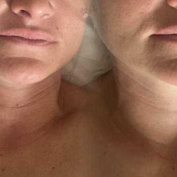 Фото с портфолио Skinphilosophy