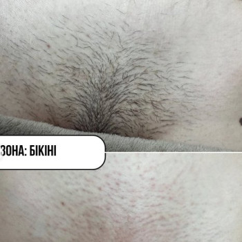 Фото с портфолио Алина 