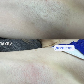Фото с портфолио Алина 