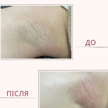 Фото с портфолио Алина 