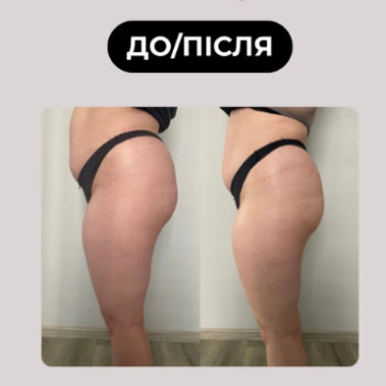 Фото с портфолио Анастасія Мрикот