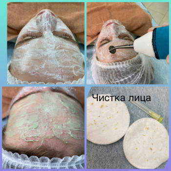 Чистка обличчя