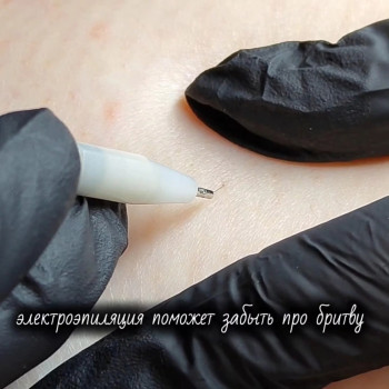 Електроепіляція-ефективне видалення небажаного волосся, навіть світлого, назавжди.Запрошуємо до нашої студії у Києві.