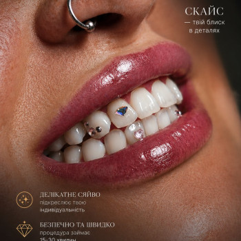 Скайси ✨️💎 Хочеш привернути більше поглядів, тоді послуга зі встановлення скайсів саме для тебе 🤩