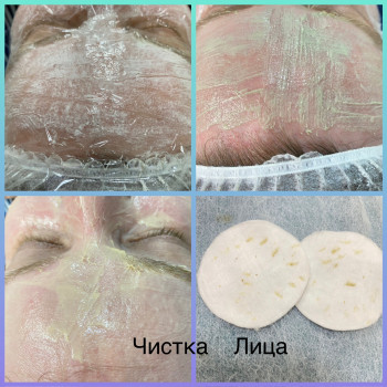 Механічна чистка обличчя