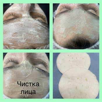 Механічна чистка обличчя