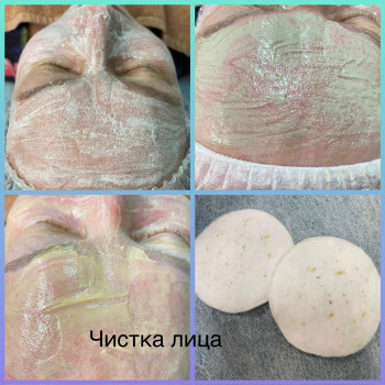 Механічна чистка обличчя