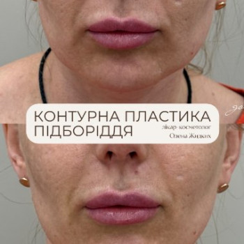 Фото с портфолио МЮ