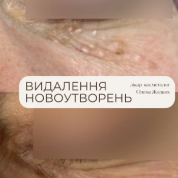 Фото с портфолио МЮ