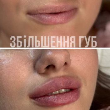 Фото с портфолио Тетяна Матющенко